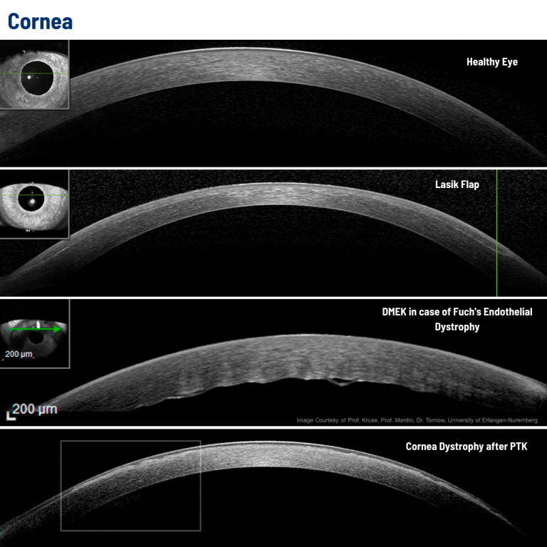 Heidelberg Spectralis Fluorescein Angiography Module INNOVA