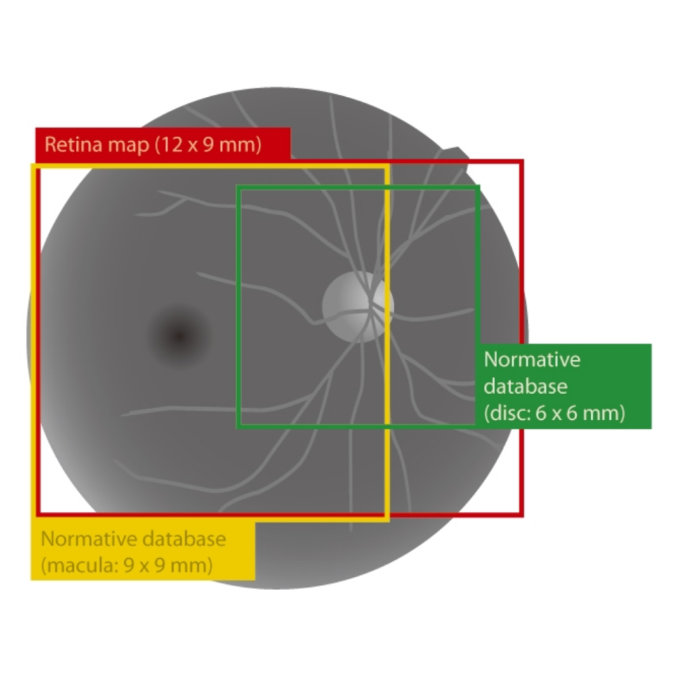 Nidek Rs Retina Scan Duo With Faf Innova