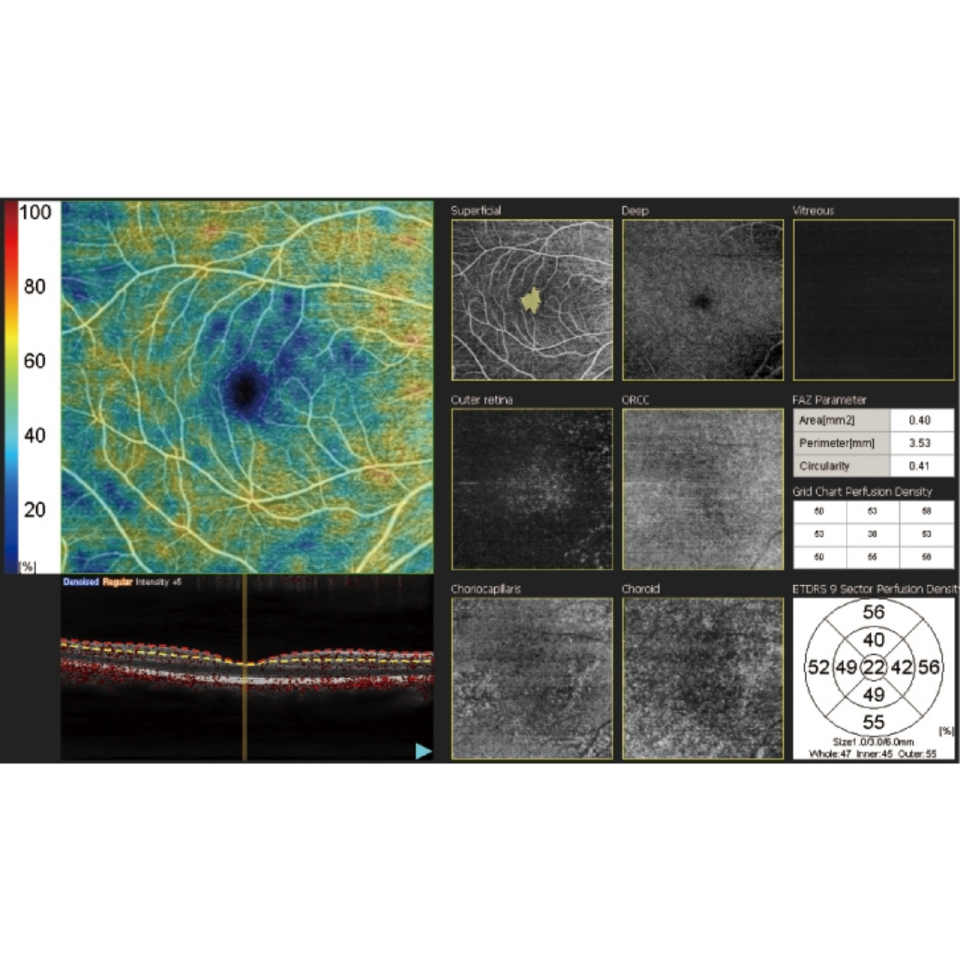 NIDEK RS 330 Retina Scan Duo 2 With FAF INNOVA