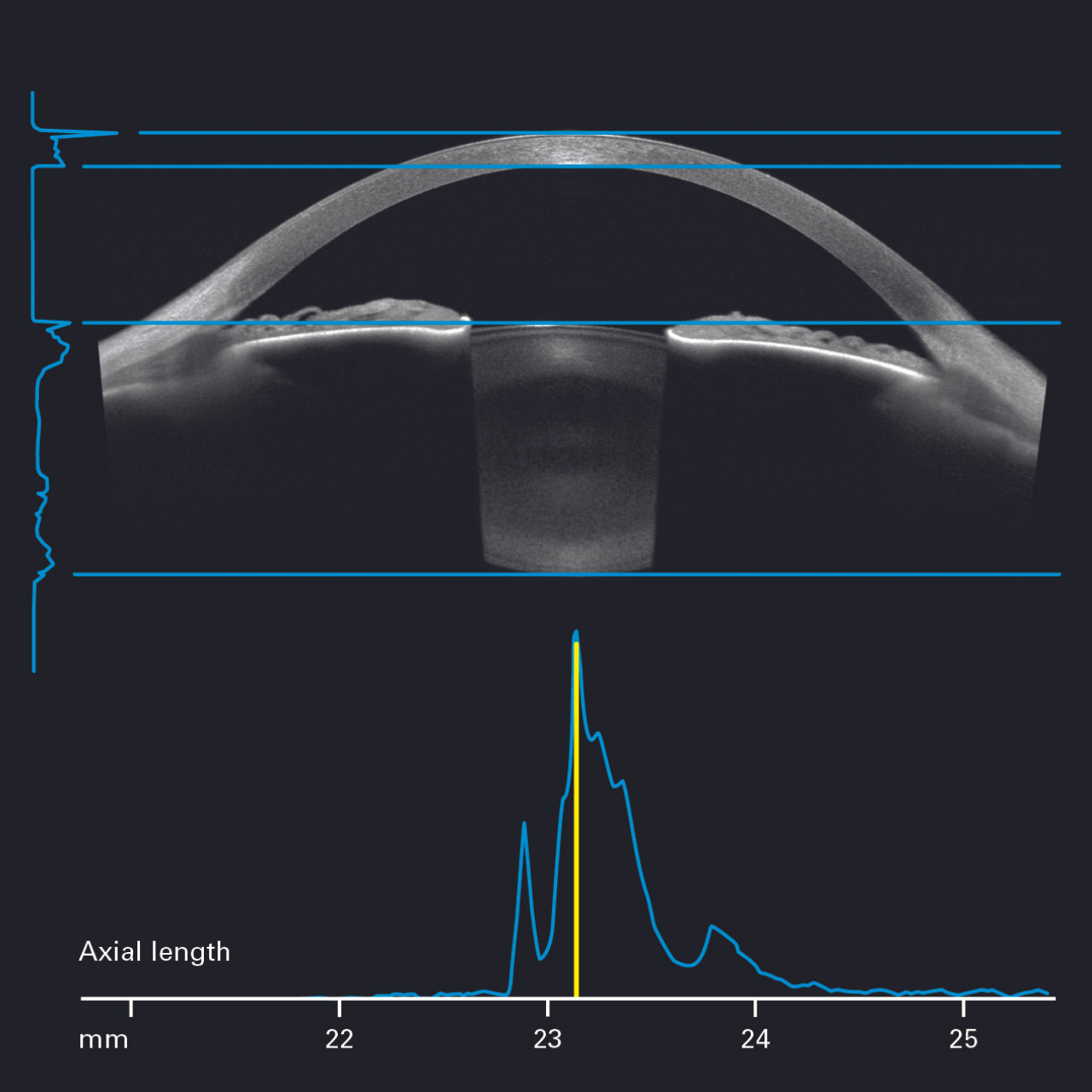 Heidelberg Anterion Multimodal Imaging Platform Innova