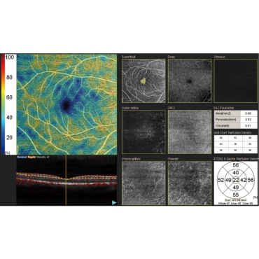 Optical Coherence Tomography / Fundus Camera
Retina Scan Duo™2 Angio scan