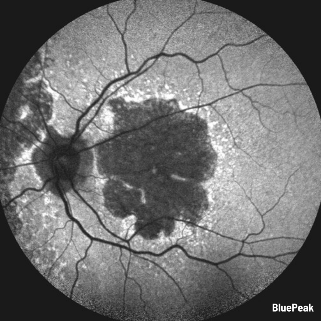 Heidelberg Spectralis – Widefield 55-degree Fundus & OCT Module – INNOVA