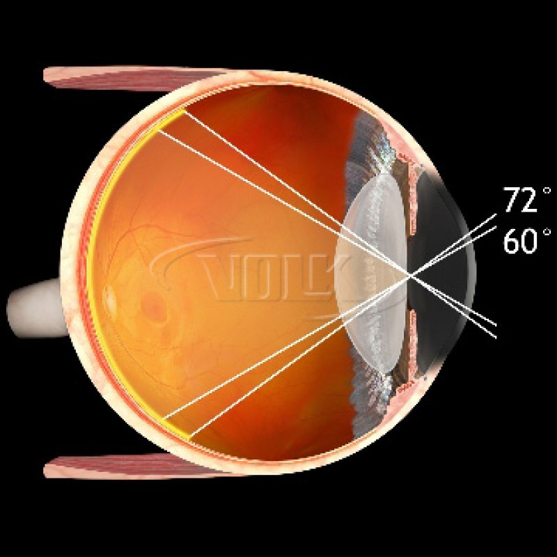 Volk Digital 1.0X Imaging Slit Lamp Lens – INNOVA