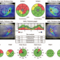 Retina map for combined diagnosis of the disc and macula